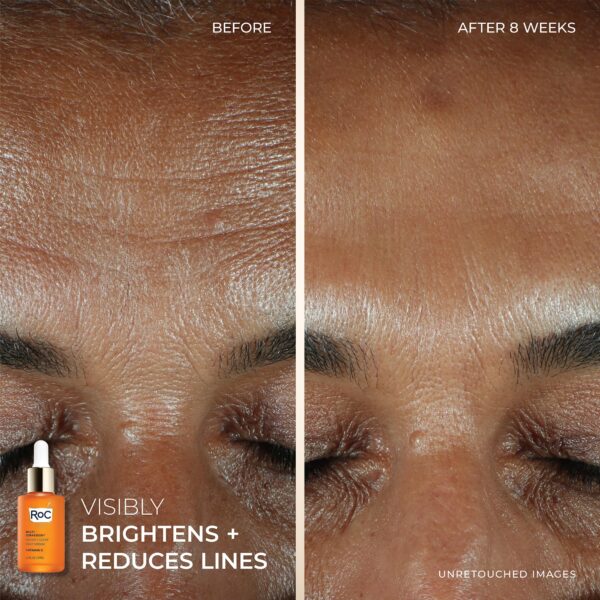 ROC vitamin C serum.7